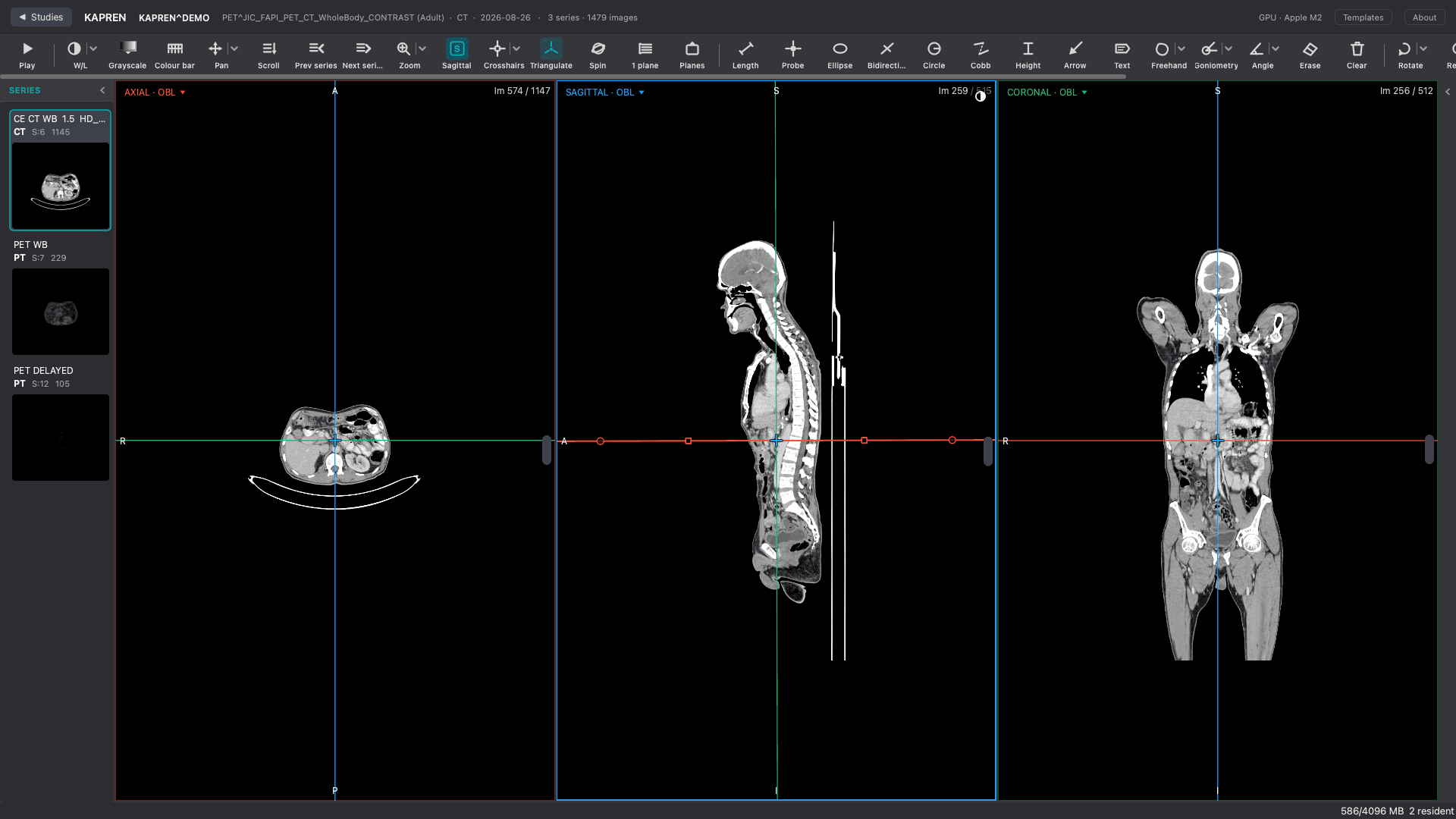 KAPREN desktop viewer — study browser, series thumbnails, 2×2 viewport, toolbar
